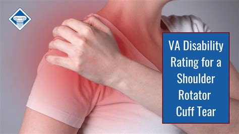 Shoulder arthroscopy and labral repair are offered at Jordan-Young Institute in Virginia Beach and Hampton Roads, VA. . Va disability rating for shoulder labral tear